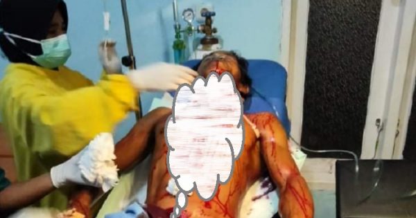 Salam, pekerja empang ditebas lehernya di Malili, Luwu Timur kini dirawat di ICU RSUD I Lagaligo, Wotu, Luwu Timur.