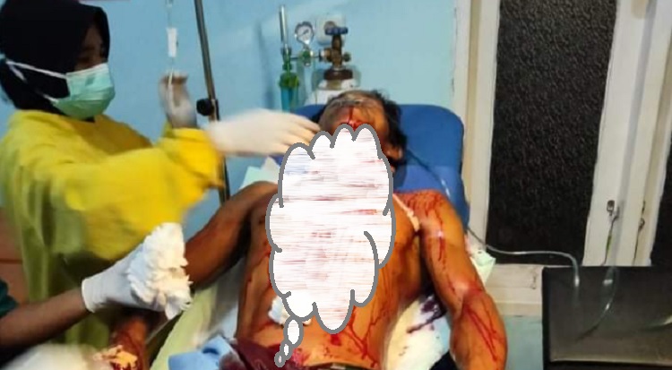 Salam, pekerja empang ditebas lehernya di Malili, Luwu Timur kini dirawat di ICU RSUD I Lagaligo, Wotu, Luwu Timur.
